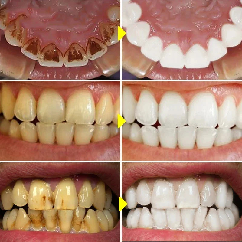 Teeth Whitening Mousse Toothpaste Remove Plaque Stain