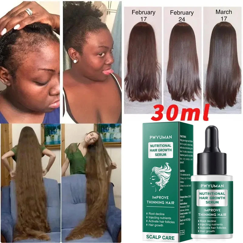 7 Days Fast Hair Growth Serum Prevents Hair Loss
