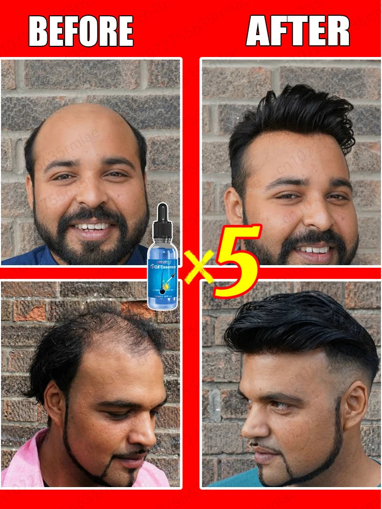 Hair Growth Essential Oil Effectively Repair Baldness