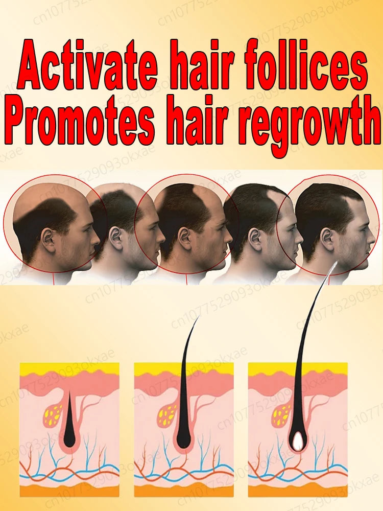 Hair Growth Essential Oil Effectively Repair Baldness