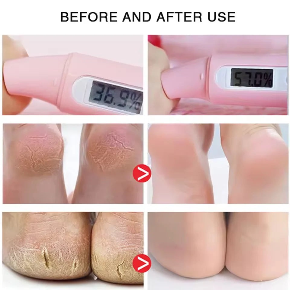 Herbal Anti Crack Foot Cream