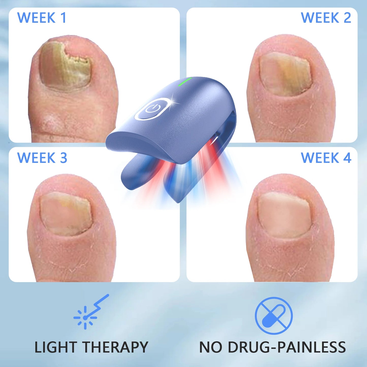 KTS Nail Fungus Cleaning Device