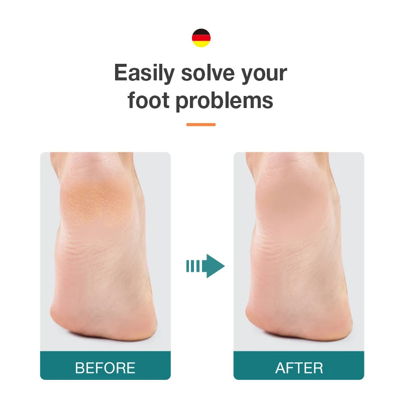 MR.GREEN Foot File Double Sided Callus Remover