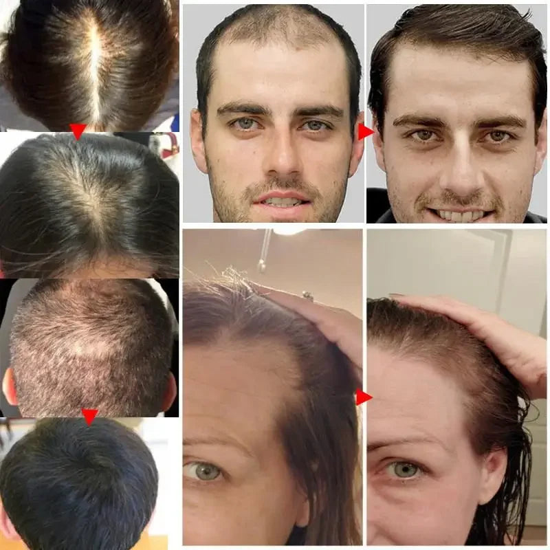 7 Days Fast Hair Growth Serum Prevents Hair Loss