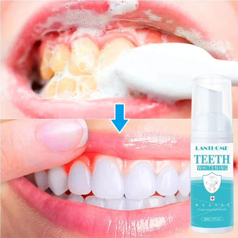 Teeth Whitening Mousse Toothpaste Remove Plaque Stain