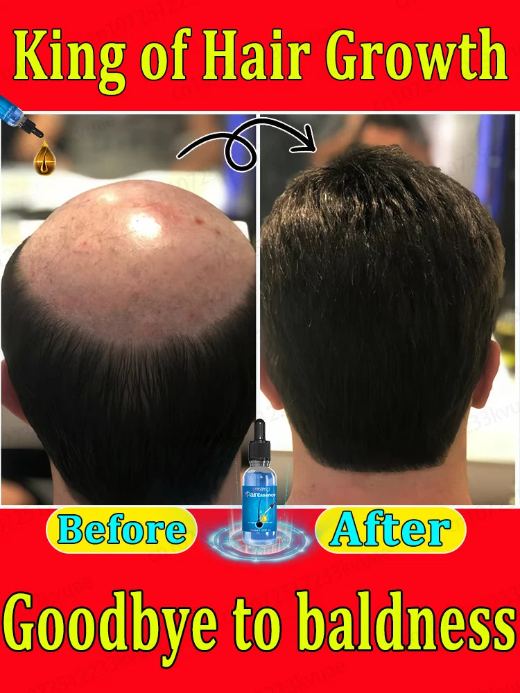 Hair Growth Essential Oil Effectively Repair Baldness