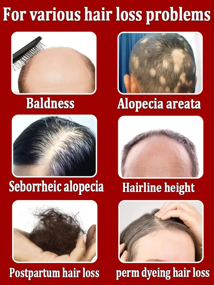 Hair Growth Essential Oil Effectively Repair Baldness