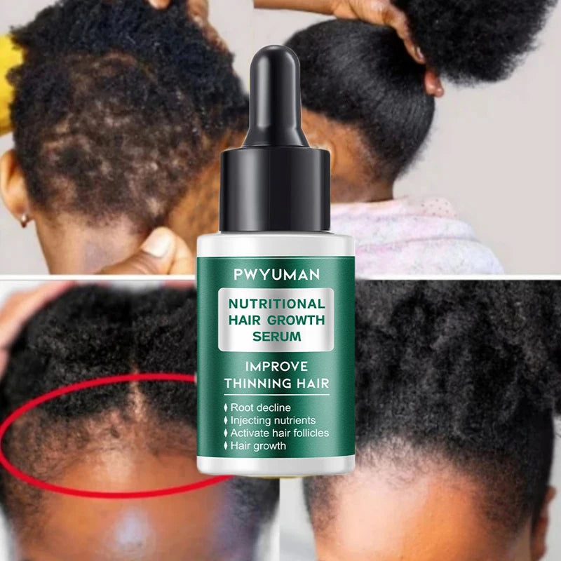 7 Days Fast Hair Growth Serum Prevents Hair Loss