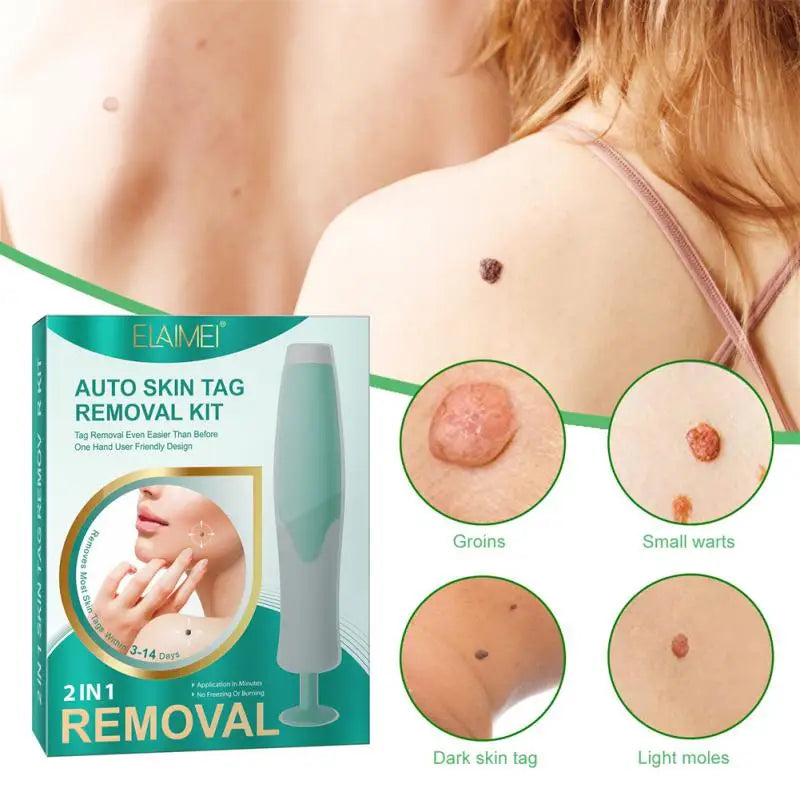 Skin Tag Removal Kit Easy And Painless