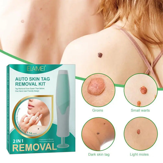 Skin Tag Removal Kit Easy And Painless