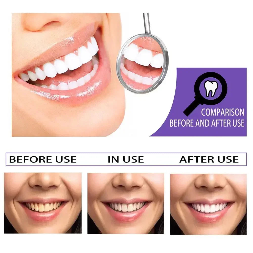 V34 Smile Teeth Whitening Toothpaste Mousse