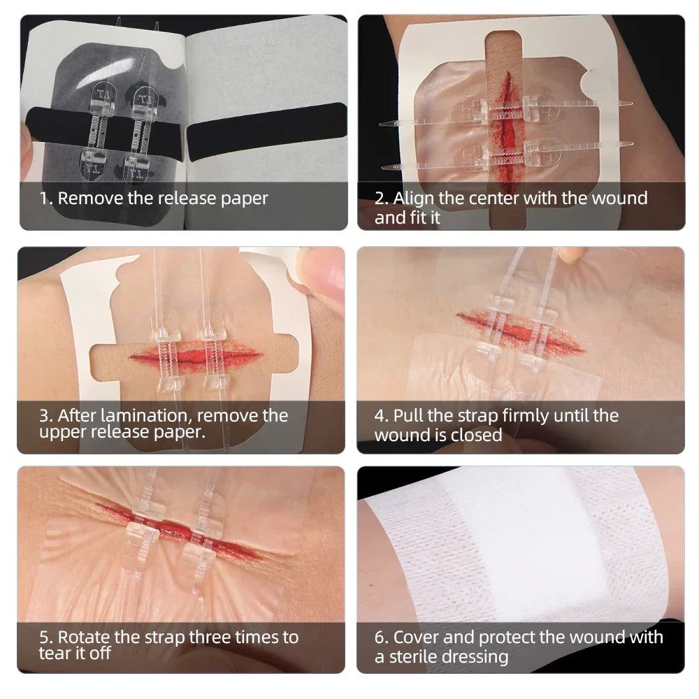 Zipper Band-Aid Wound Closure Device