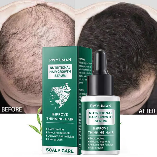 7 Days Fast Hair Growth Serum Prevents Hair Loss