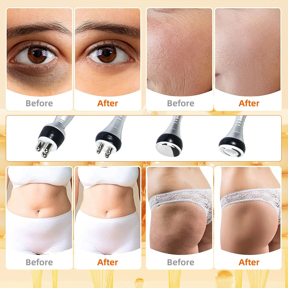 Four-in-One Ultrasonic Slimming Skin Tightening Vacuum