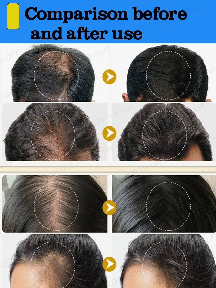 Rapid Growth Hair Oil
