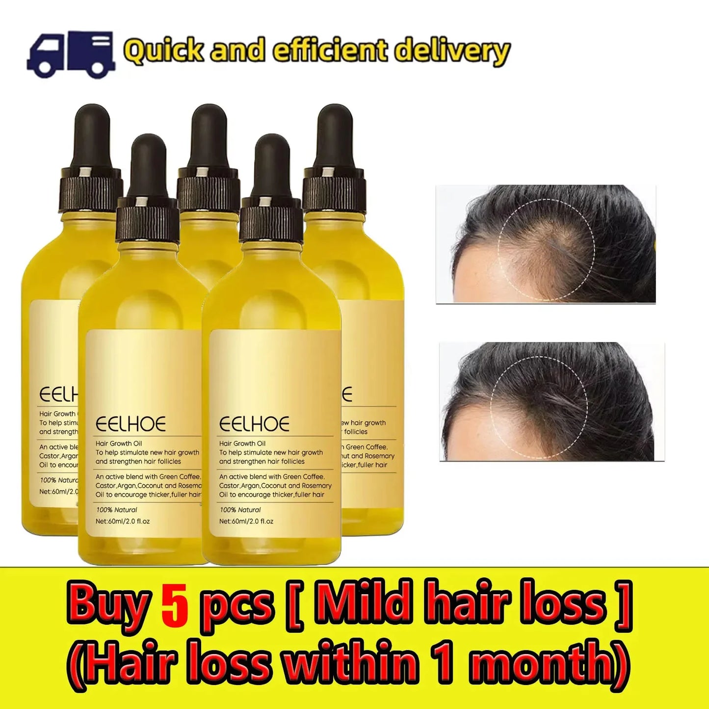 60ml Rosemary Anti-loss Hair Regrowth Essential Oil Scalp Treatment