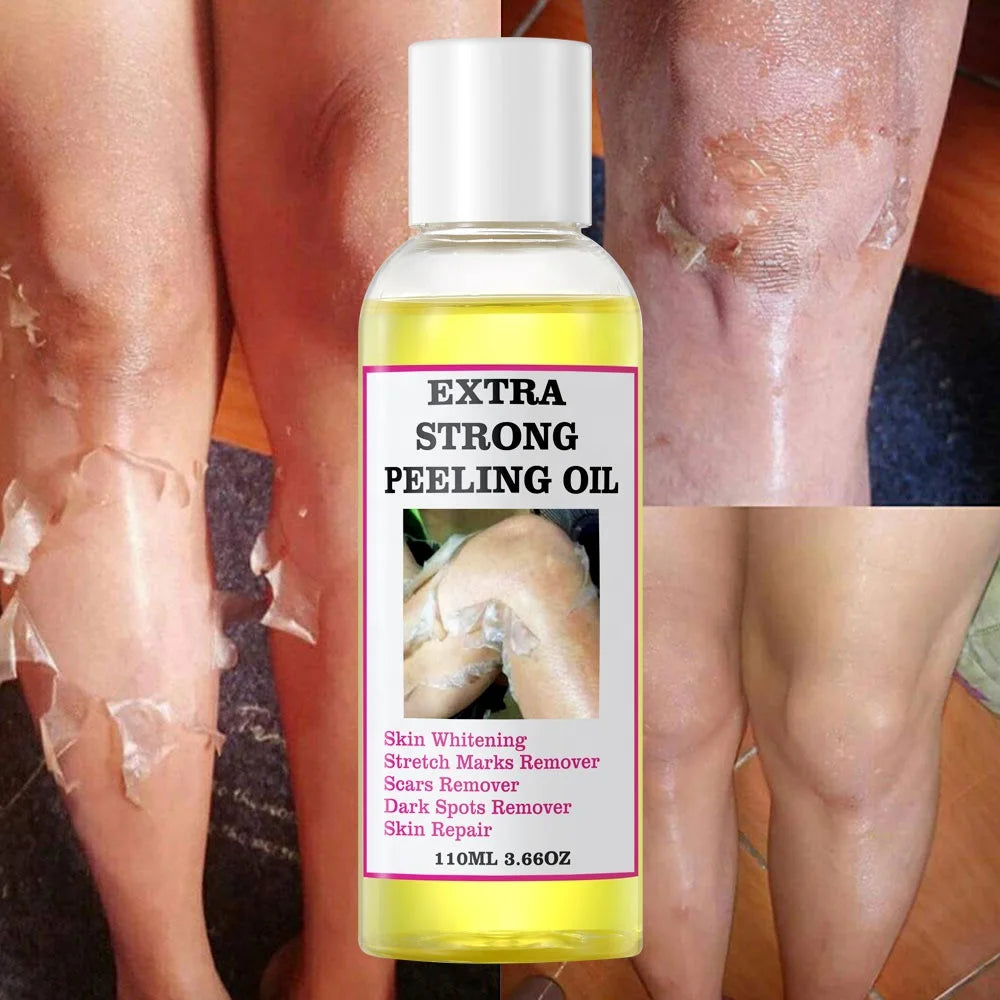 Yellow peeling oil lighten elbows knees hands