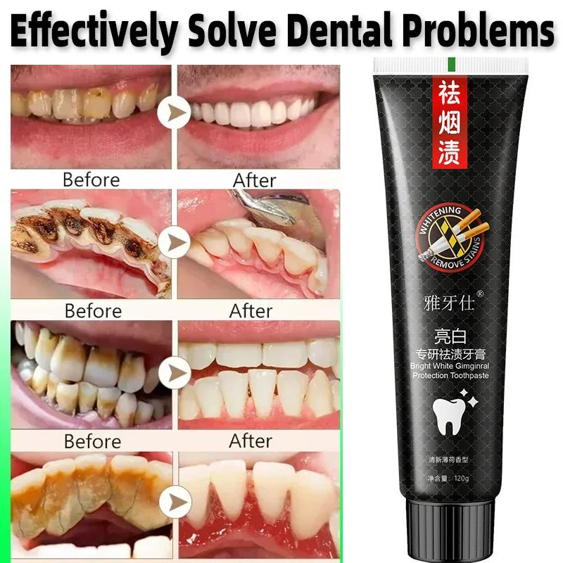 Fast Remove Smoke Stains Toothpaste Teeth Whitening Pen