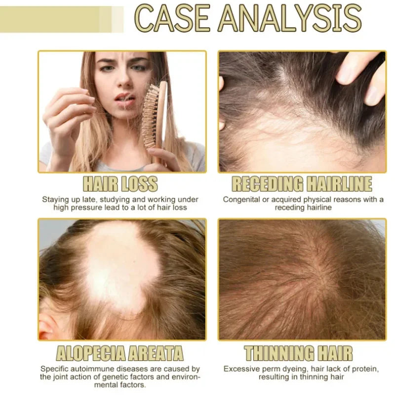 60ml Rosemary Anti-loss Hair Regrowth Essential Oil Scalp Treatment