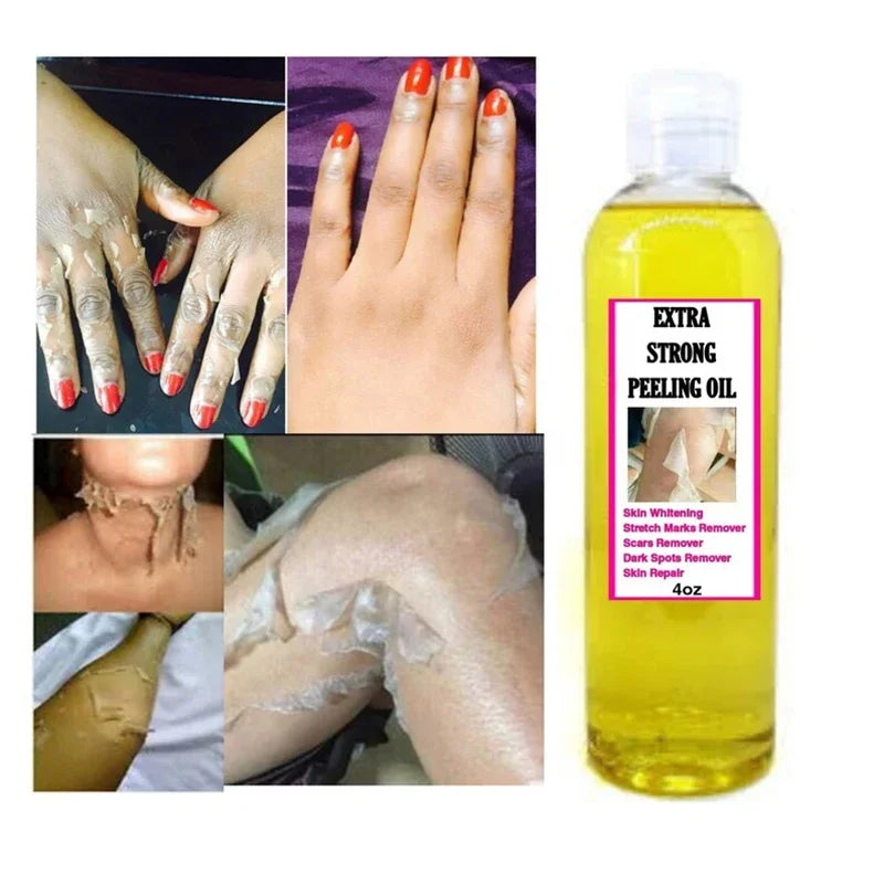 Yellow peeling oil lighten elbows knees hands