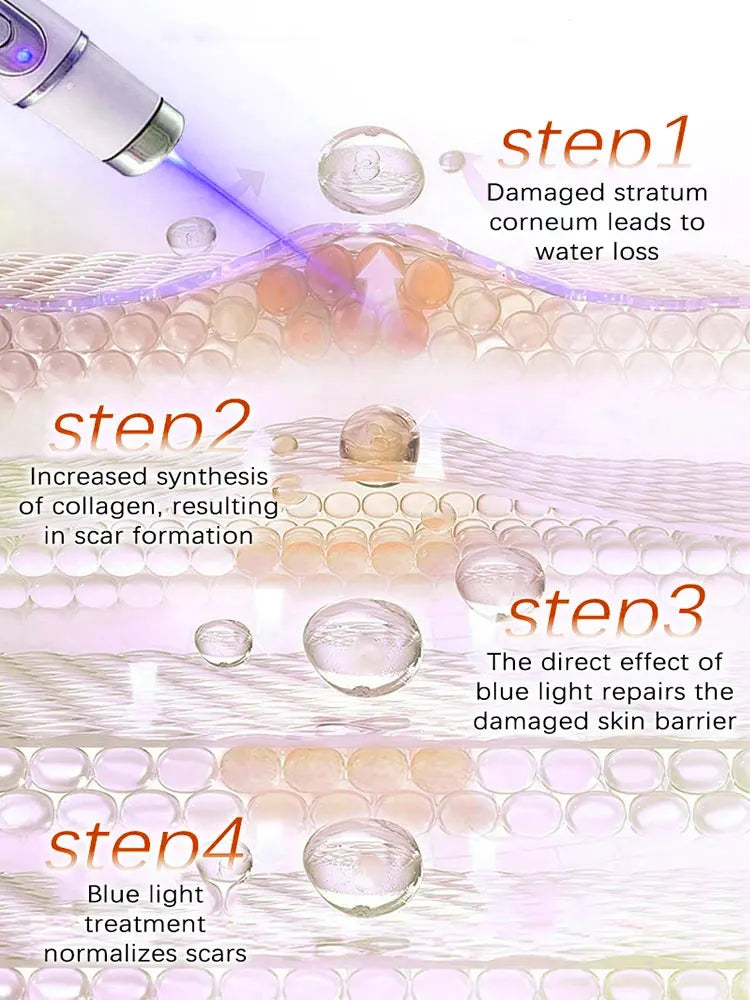 Blue Light Pen Painless Laser Removes Scars Acne