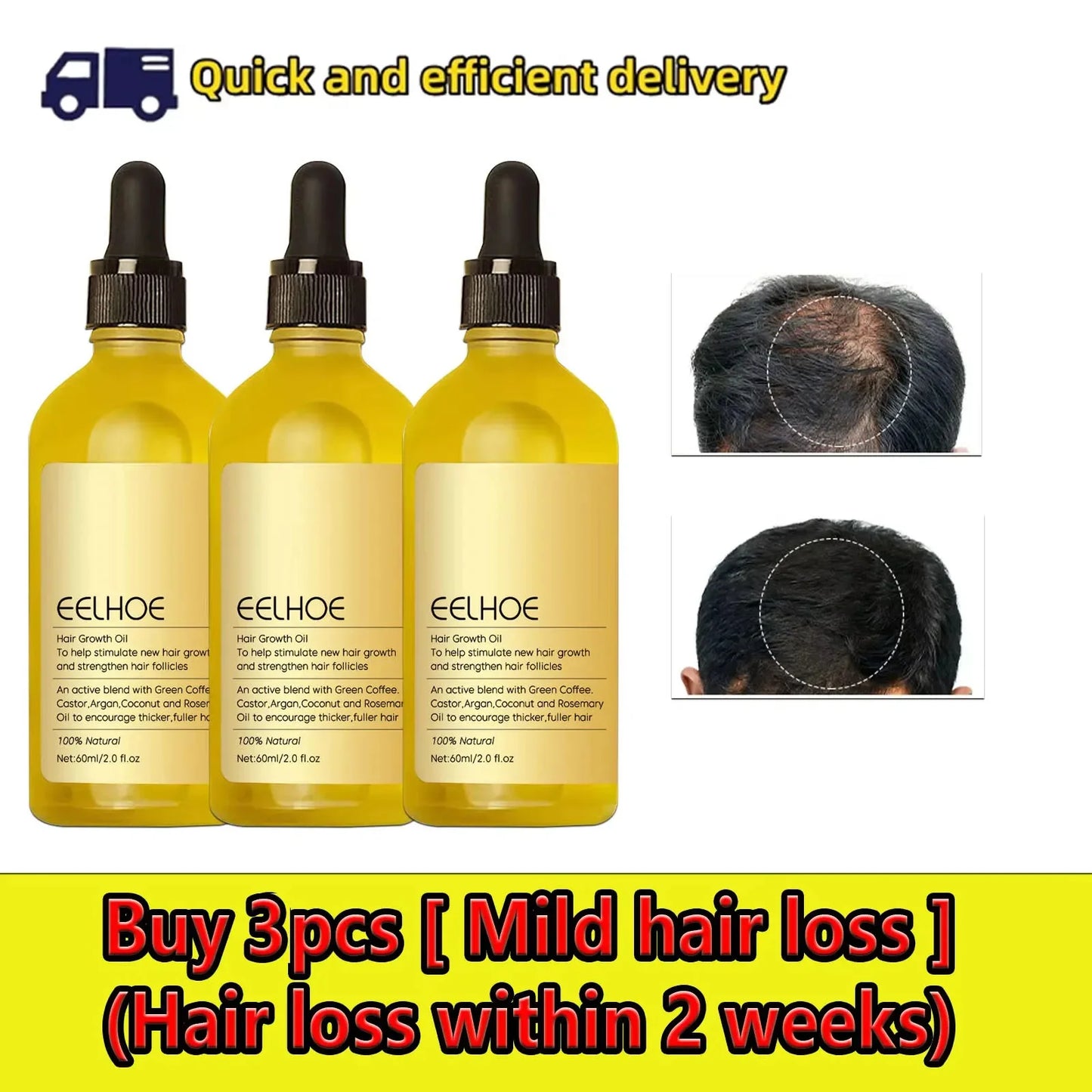 60ml Rosemary Anti-loss Hair Regrowth Essential Oil Scalp Treatment