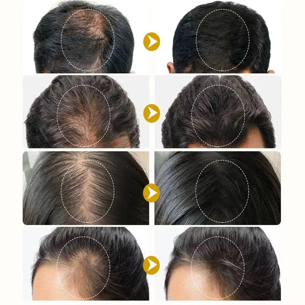 60ml Rosemary Anti-loss Hair Regrowth Essential Oil Scalp Treatment