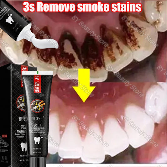 Fast Remove Smoke Stains Toothpaste Teeth Whitening Pen