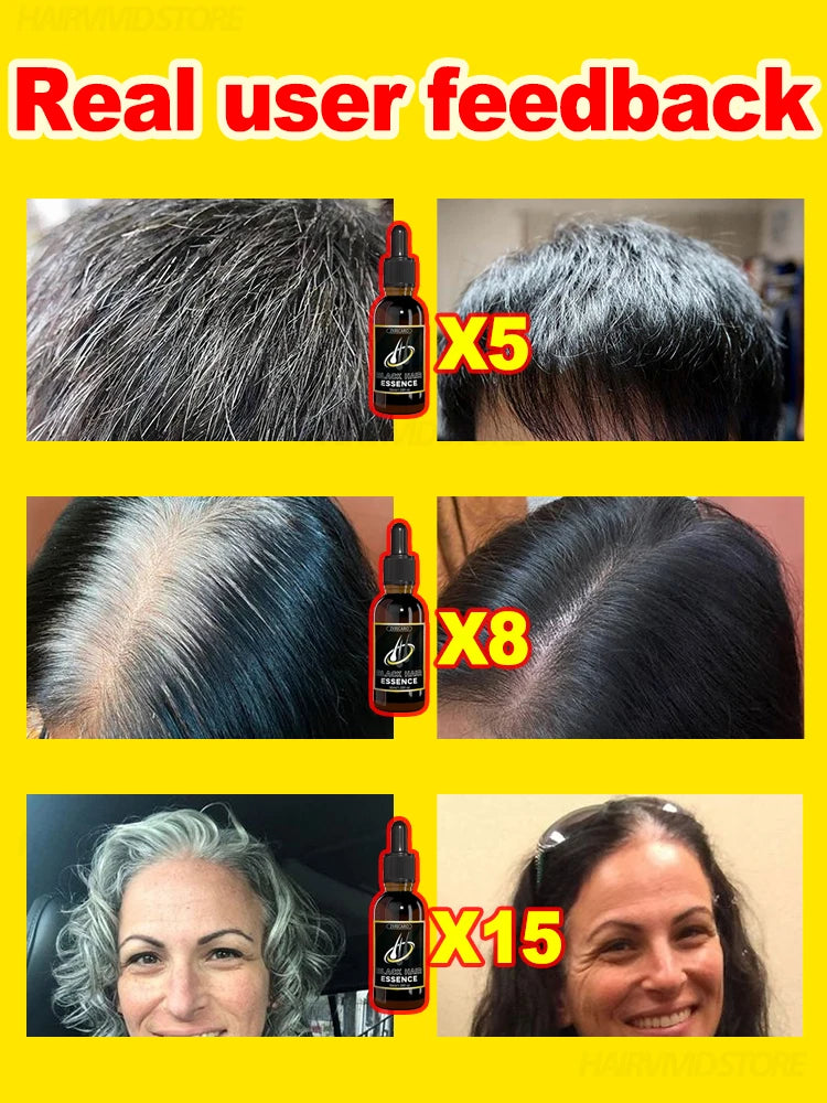 Natural Color/ Anti Gray & Darkening Hair Remedy