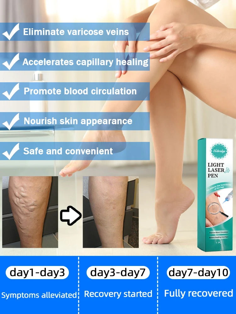 Laser leg vein repair