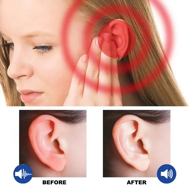 Ear Wax Remover Spray Soften Earwax Clean Canal Blockage