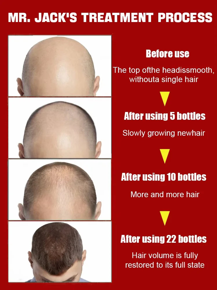 30ml Hair Massage and Growth Oil