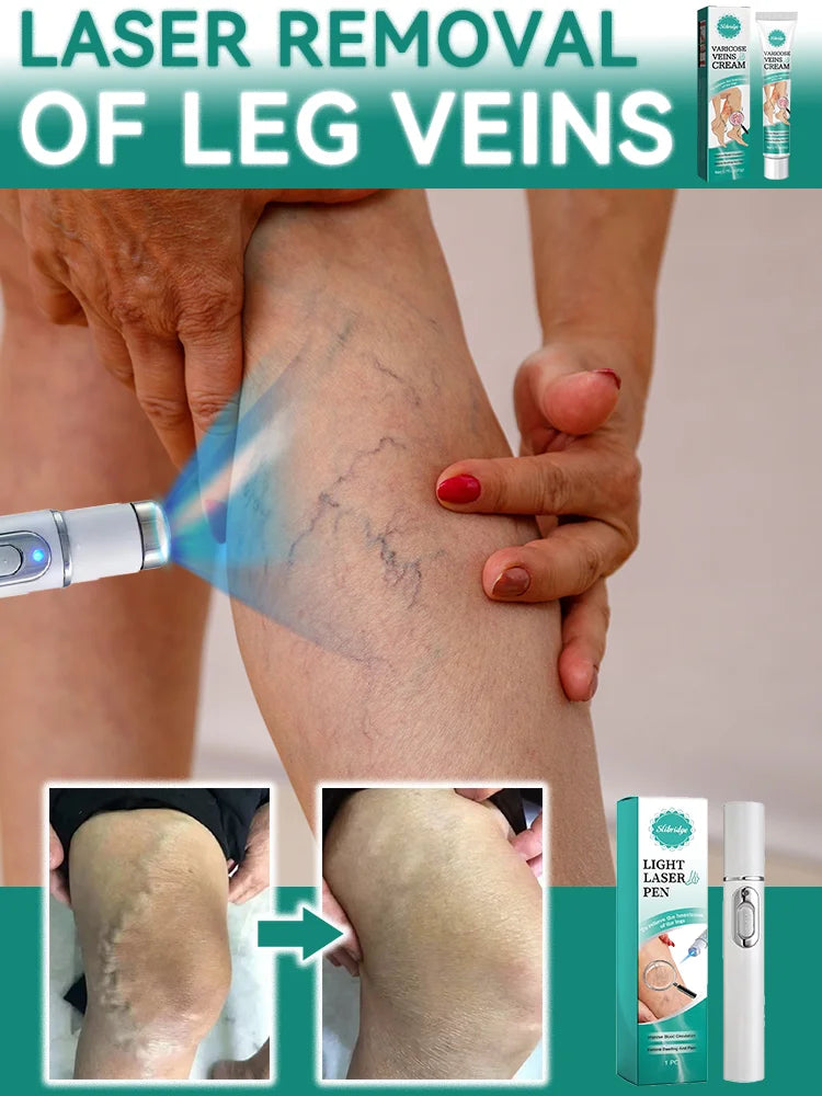 Laser leg vein repair