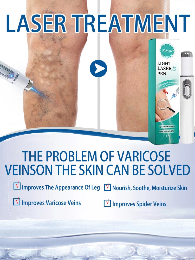 Laser leg vein repair