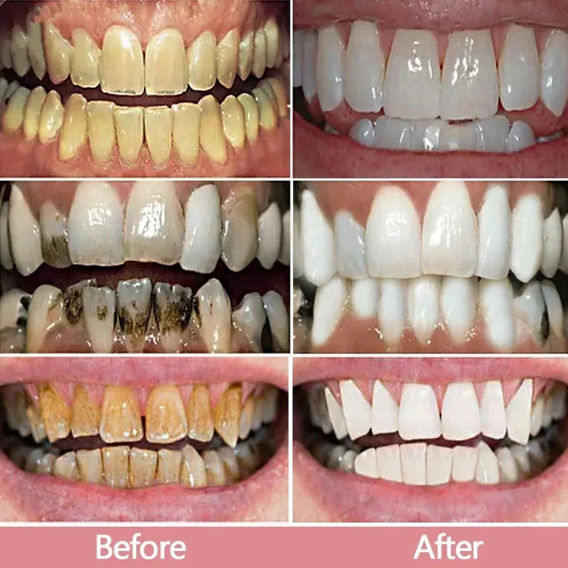 V34 Smile Teeth Whitening Toothpaste Mousse