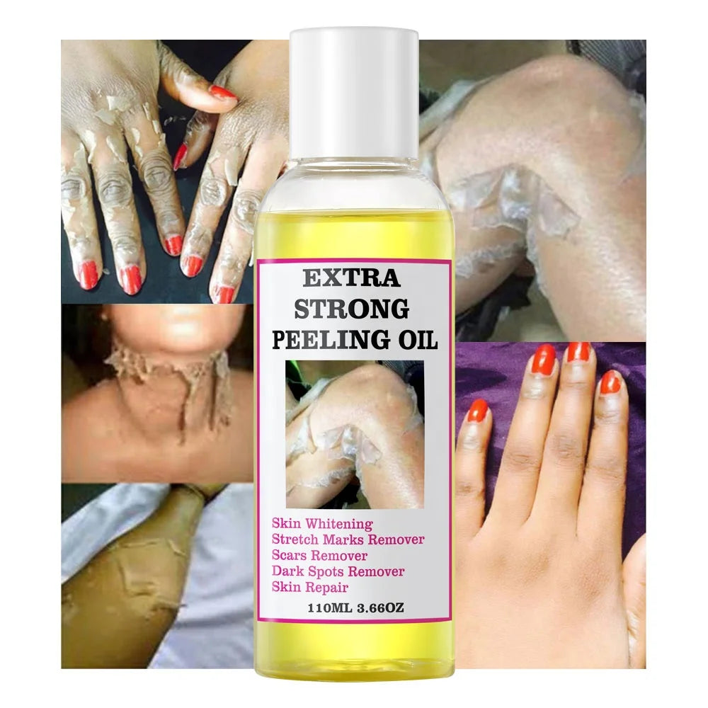 Yellow peeling oil lighten elbows knees hands