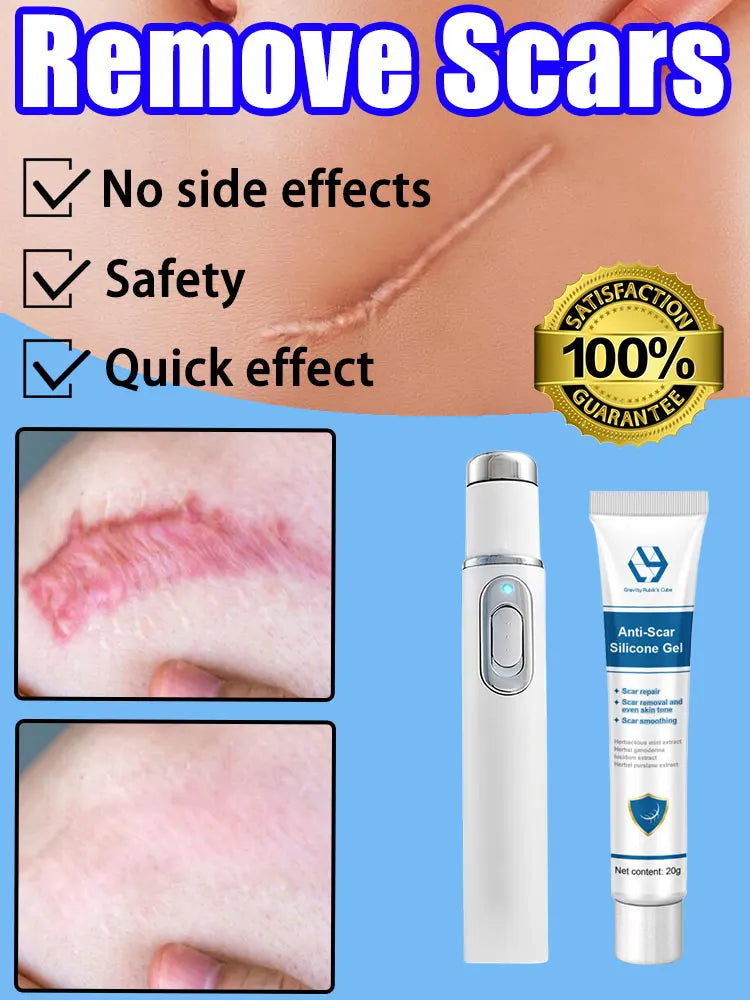 Blue Light Pen Painless Laser Removes Scars Acne