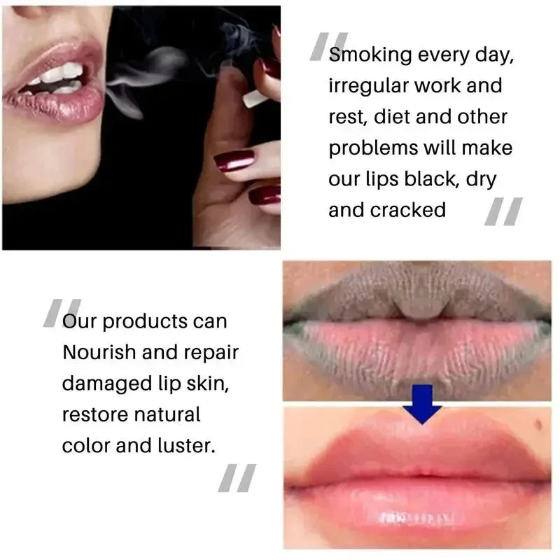 Remove Dark Lip Balm Lightening Melanin Gloss Oil