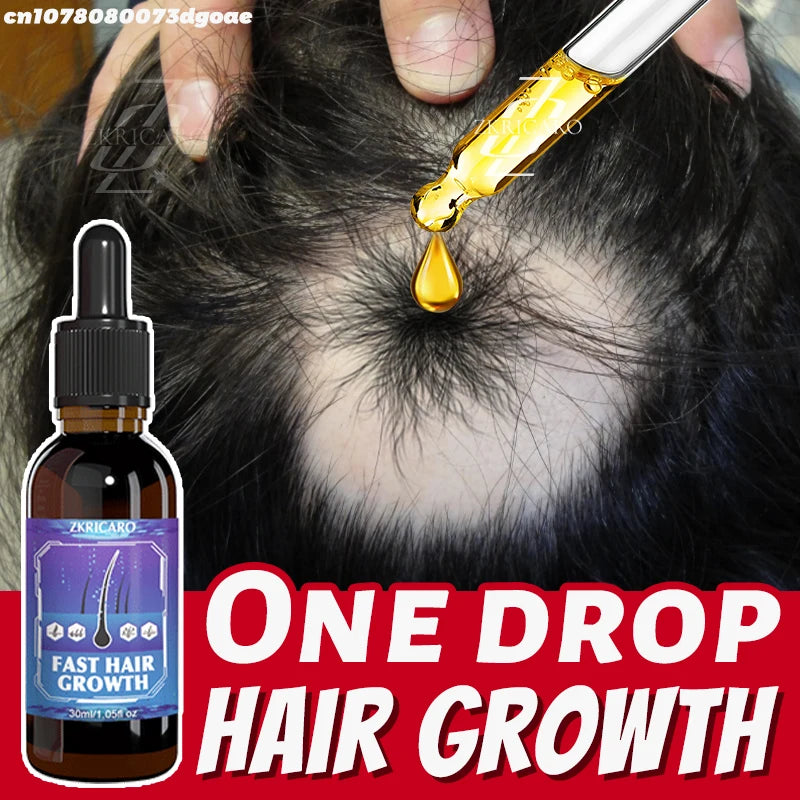 30ml Hair Massage and Growth Oil