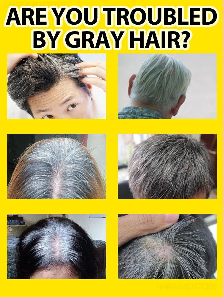 Natural Color/ Anti Gray & Darkening Hair Remedy