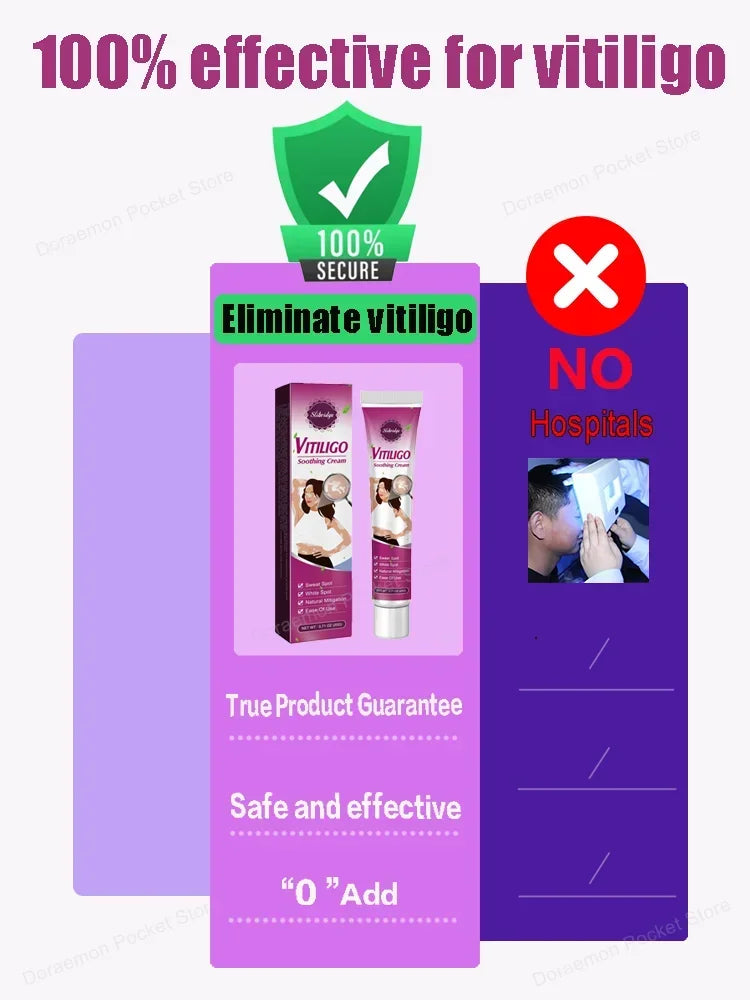 Vitiligo Ointment Effectively Improve White Spot Skin Eliminate