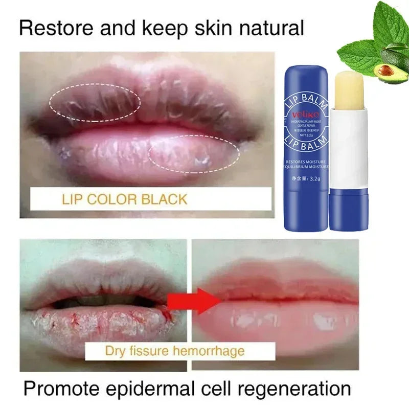 Remove Dark Lip Balm Lightening Melanin Gloss Oil
