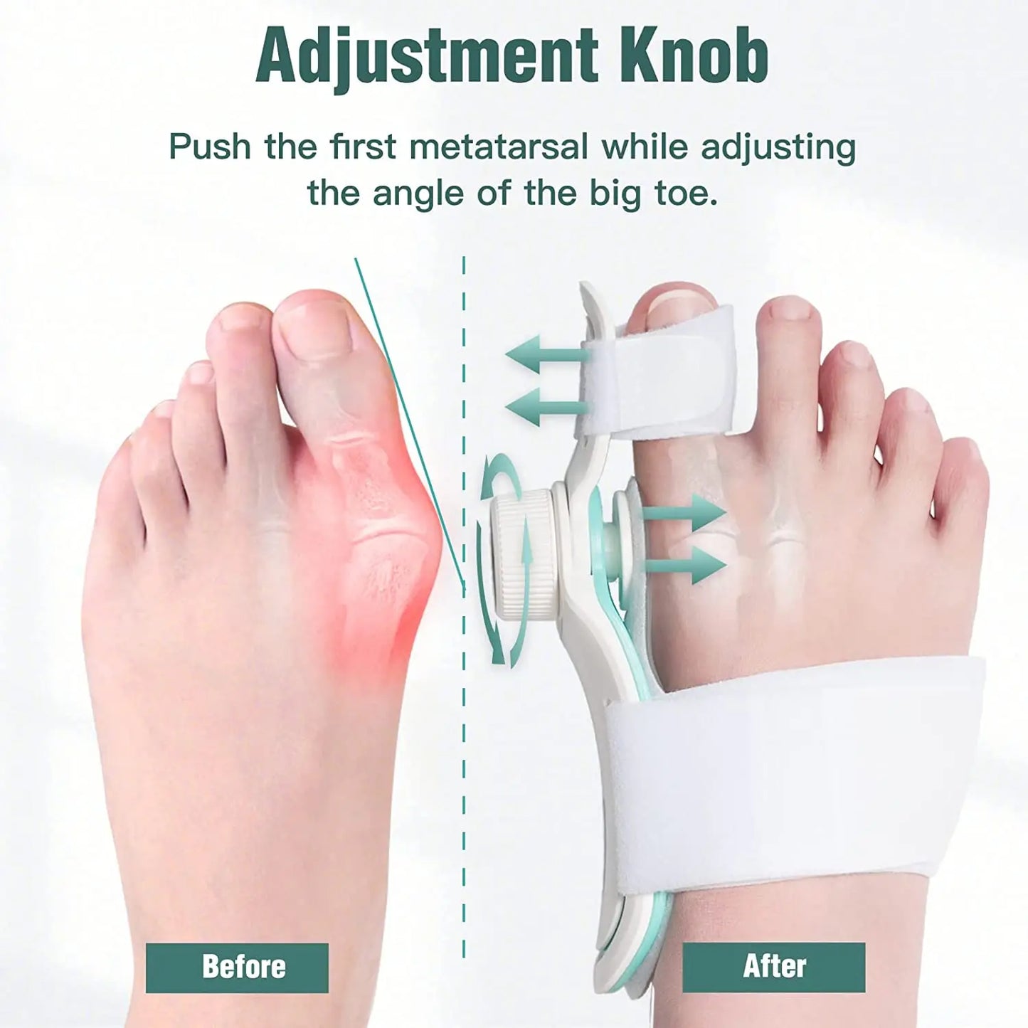 Foot Care Bunion Corrector Orthopedic Bunion Splint