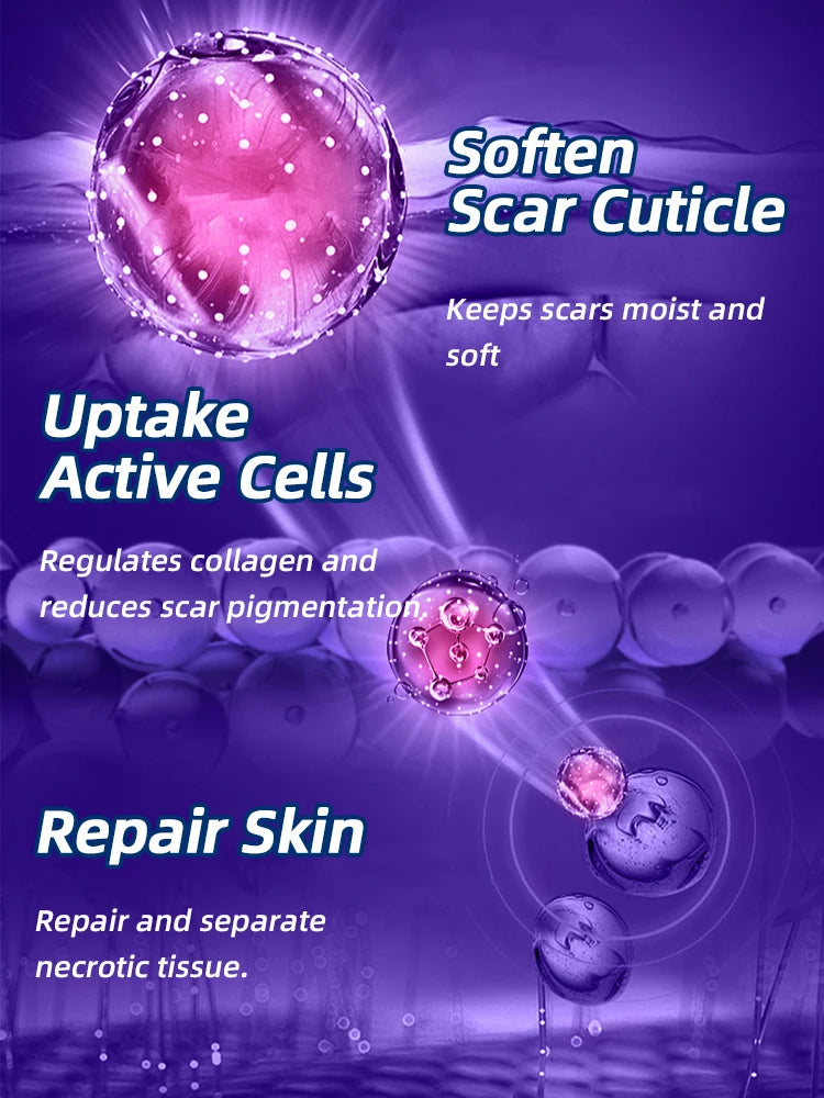 Keloid Removal Cream