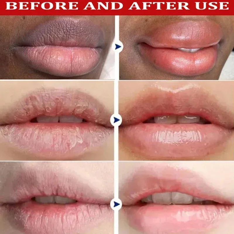 Remove Dark Lip Balm Lightening Melanin Gloss Oil