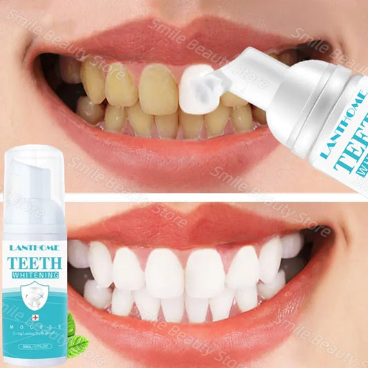 Teeth Whitening Mousse Toothpaste Remove Plaque Stain